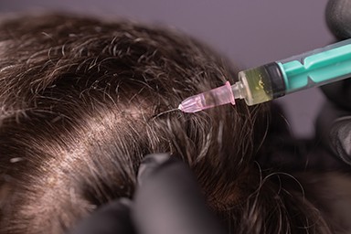 Hair Loss Treatment Richmond, VA