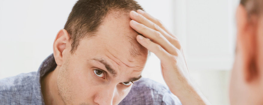 Hair Restoration Richmond, VA