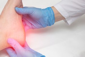 Healing from Within: How PRP Injections Can Relieve Plantar Fasciitis Pain Richmond, VA