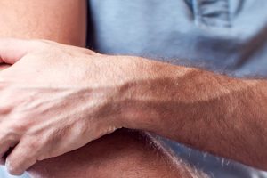 How Regenerative Medicine Can Help Tennis Players and Golfers Recover From Elbow Injuries Richmond, VA