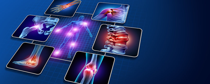 Joint Pain Richmond, VA
