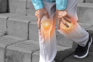 Patient experiencing knee pain while walking up stairs in Richmond.