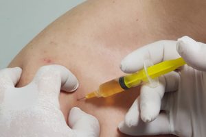 PRP For Shoulder Pain Richmond, VA