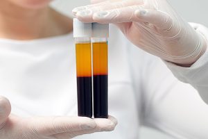 PRP therapy recovery timeline and aftercare with a regenerative medicine provider in Richmond, Virginia
