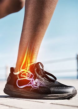 Regenerative Medicine Treatments for Severe Plantar Fasciitis Richmond, VA
