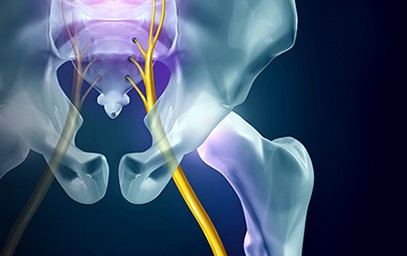 Sciatic Nerve Pain Richmond, VA