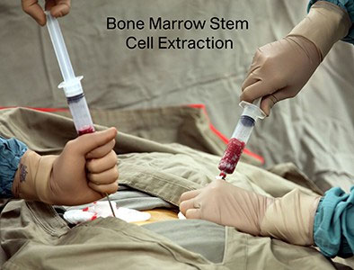 Stem Cells Richmond